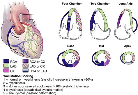 Overview of stress echocardiography .